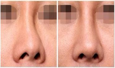 鼻孔中間叫什麼 行衰運 化解
